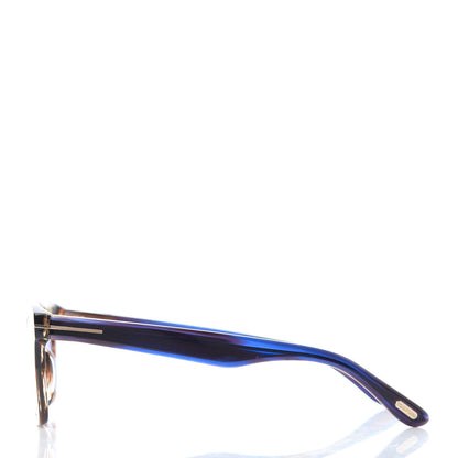 Tom Ford Acetate Dax Sunglasses TF751 Blue 2 of 8